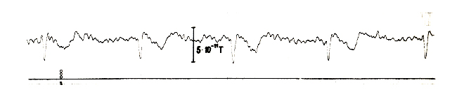 Bild9_MagnetokardiogrammdererstenStunde.jpg