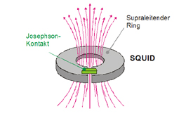 SQUID schematisch